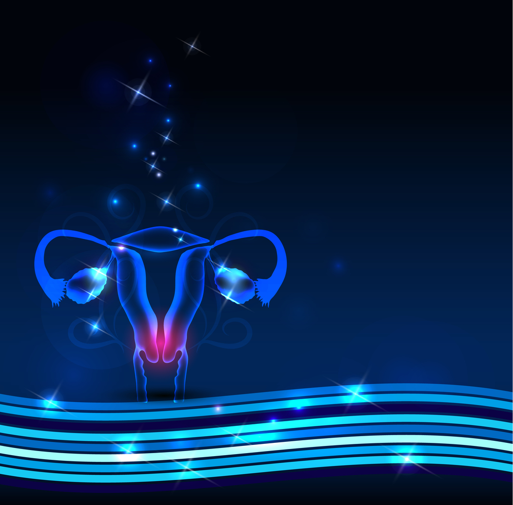 Polycystic Ovary Syndrome